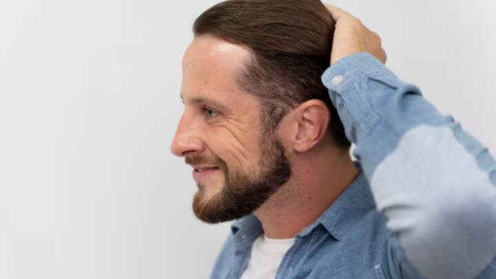 কান এবং কপালের মাঝের অংশকে বলা হয় ‘টেম্পল’। ভবিষ্যতে টাক পড়ার সম্ভাবনা থাকলে, সেখানেই তার প্রথম ইঙ্গিত বোঝা যায়। দেখবেন, ওই জায়গায় চুল ক্রমশ পাতলা হচ্ছে।