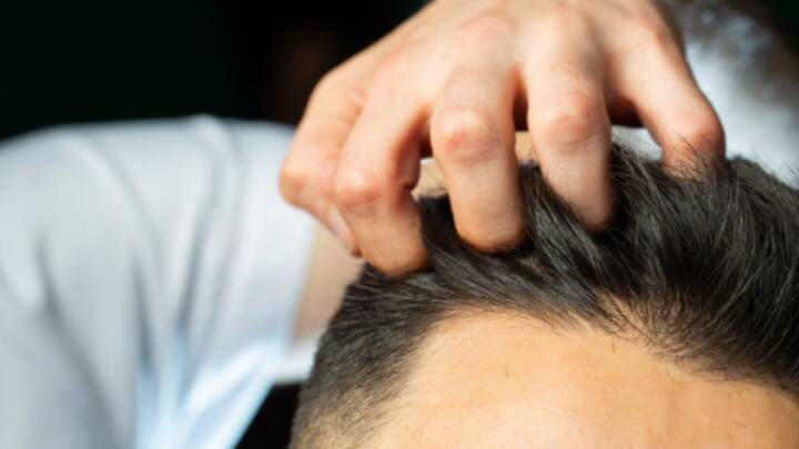 ভুরু, দাড়ি-সহ শরীরের অন্য অংশের রোমও কি পাতলা হচ্ছে? এক্ষেত্রে নেপথ্য কারণ হতে পারে অসুস্থতা।