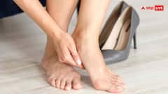 सर्दी में फटने लगी हैं एड़ियां, महंगी क्रीम नहीं ये घरेलू नुस्खे आएंगे काम