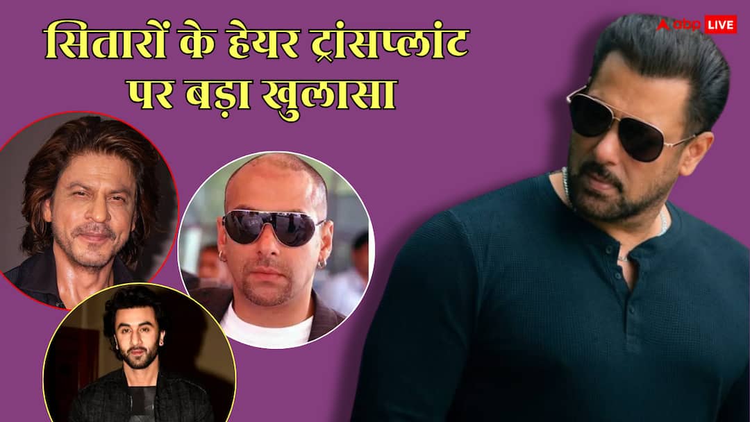 सलमान खान 5-6 बार करा चुके हैं हेयर ट्रांसप्लांट, डर्मेटोलॉजिस्ट ने रणबीर-शाहरुख के बालों की भी खोली पोल