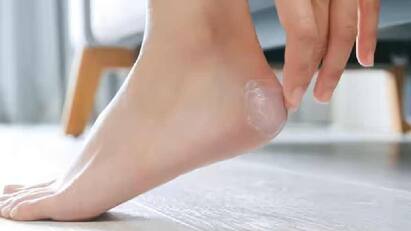 Cracked Heels Remedy : શિયાળામાં તમારી એડી નરમ રાખવા માટે દરરોજ નારિયેળ તેલ, મોઇશ્ચરાઇઝર અથવા ઘરે બનાવેલા મિશ્રણનો ઉપયોગ કરીને તમારા પગને સ્વચ્છ રાખો.