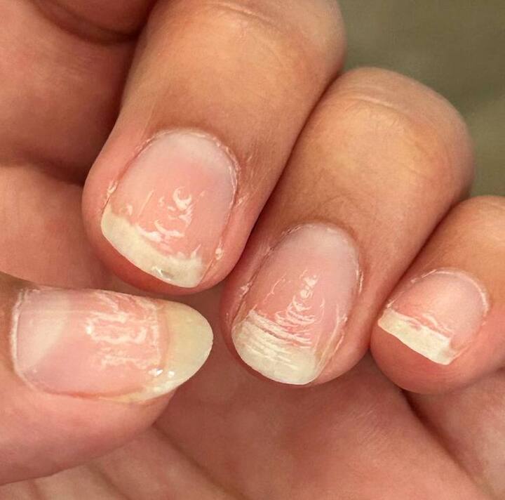 शरीराच्या आरोग्यासाठी तसेच नखांच्या मजबुतीसाठी कॅल्शियम, फॉस्फरस आणि मॅग्नेशियमचे योग्य प्रमाणात सेवन करणे आवश्यक आहे.