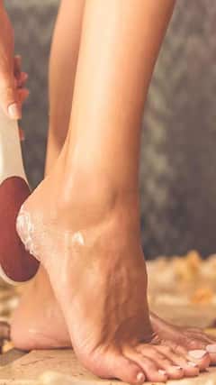 Cracked Heels Remedy : આ સરળ પદ્ધતિથી ફાટેલી એડીઓથી છૂટકારો મેળવો!