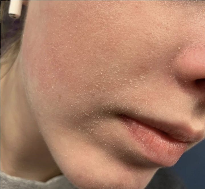 नाभी ही शरीरातील सर्व नसांशी जोडलेली असल्यामुळे ती संपूर्ण शरीराचे पोषण करते.