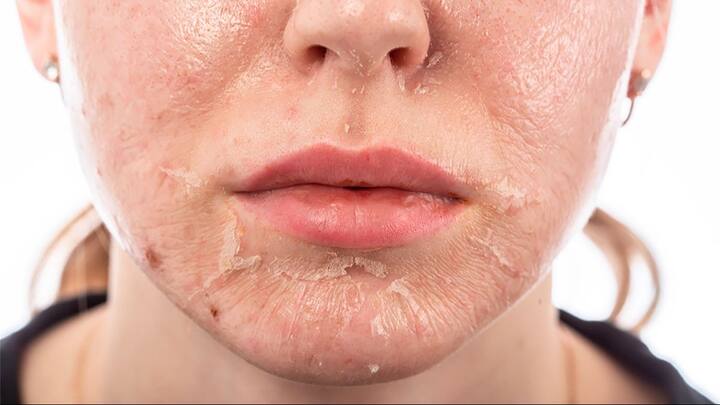 हे टाळण्यासाठी शरीरातील ओलावा टिकवून ठेवणे महत्त्वाचे आहे, आणि त्यासाठी नाभीची काळजी घेणे अत्यंत आवश्यक ठरते.