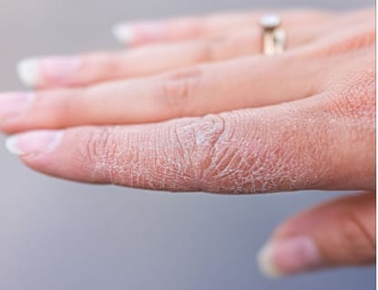 दररोज रात्री नाभीला तूप किंवा तेल लावल्याने शरीराला  पोषण मिळते आणि त्वचा निरोगी व तजेलदार राहते.