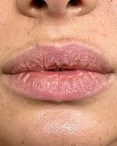 Dry Skin Remedies : हिवाळ्यात कोरडी त्वचा आणि फाटलेले ओठ टाळण्याचा सोपा उपाय!