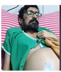 ਲੀਵਰ ਦੀ ਬਿਮਾਰੀ ਕਾਰਨ ਮਸ਼ਹੂਰ ਕਲਾਕਾਰ ਦਾ ਸਰੀਰ ਬਣਿਆ ਪਿੰਜਰ, ਇੰਝ ਹੋਈ ਮੌਤ...