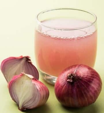 ਵਾਲਾਂ ਦੀ ਸਿਹਤ ਲਈ ਪਿਆਜ਼ ਦਾ ਜਾਦੂਈ ਰਸ: ਵਾਲਾਂ ਨੂੰ ਮਜ਼ਬੂਤ ਅਤੇ ਚਮਕਦਾਰ ਬਣਾਓ!