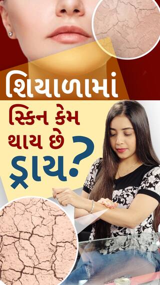 Health Tips : શિયાળામાં સ્કિન કેમ થાય છે ડ્રાય?