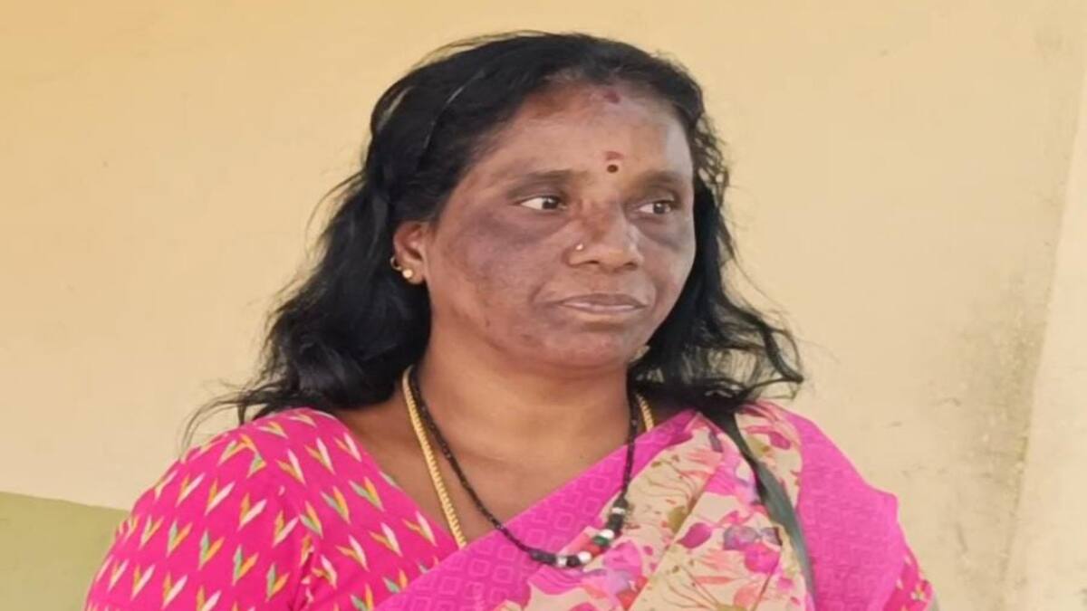 "இந்த எஸ்சி பசங்களே இப்படிதான் எப்ப பாரு 2 முட்டை சாப்பிடுறாங்க" - சத்துணவு அமைப்பாளர் அடாவடி பேச்சு