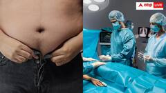 पतला होकर गर्लफ्रेंड के परिवार को करना चाहता था इंप्रेस! सर्जरी के दौरान हो गई आशिक की मौत- यूजर्स हैरान