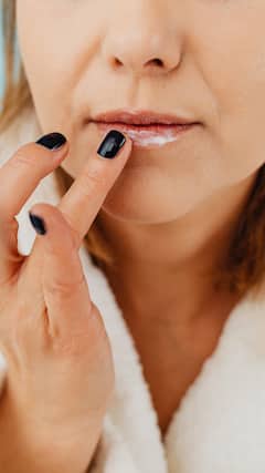 5 Sneaky Health Issues Behind Your Constantly Chapped Lips