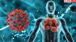 TB Surveillance System: AI ने ढूंढा टीबी को रोकने का नया तरीका, घटेंगे मौत के आंकड़े! जानें कैसे काम करती है यह तकनीक?