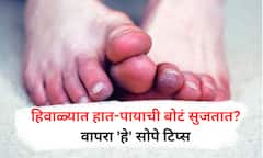 cold exposure effects : थंडीत हात-पायाची बोटं सुजतात? वेदना होतात? 'हे' सोपे उपाय देतील आराम