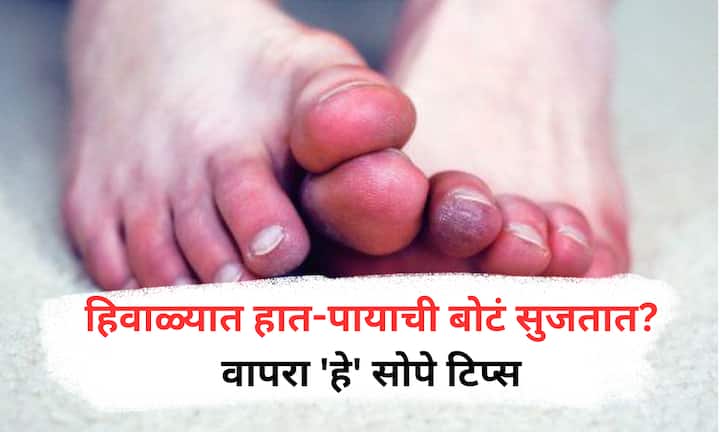 cold exposure effects : हिवाळ्यात थंडीमुळे हात-पायांमध्ये चिलब्लेन्सची समस्या उद्भवते, ज्यासाठी आरामदायी चप्पले, कोमट पाणी, हात-पायांची हलकी मालिश, हळूहळू उब देणे आणि उबदार आहार घेणे आवश्यक आहे.