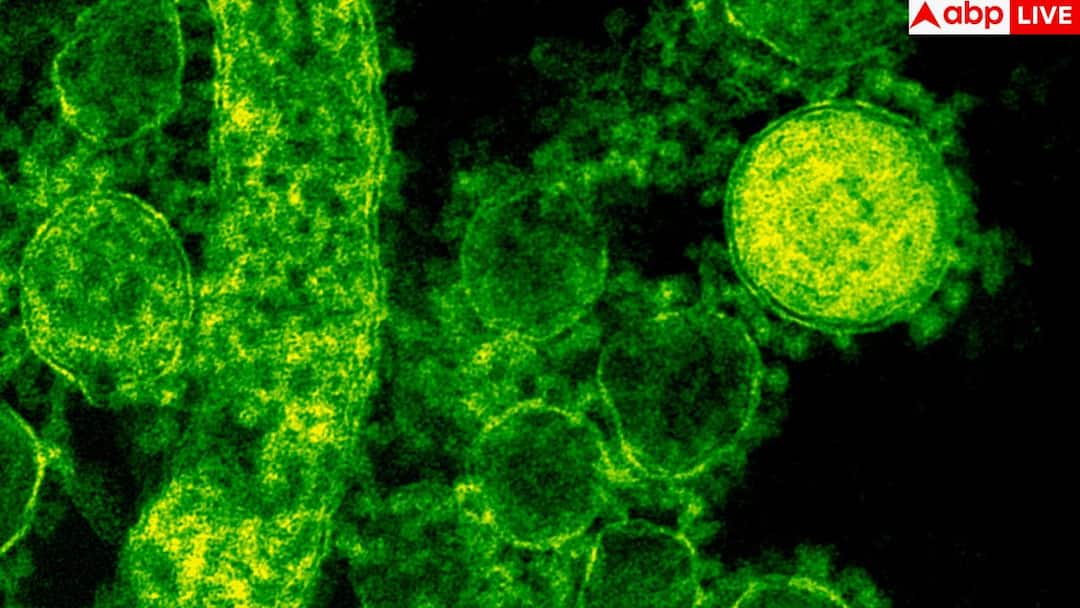 देश में वायरल इंफेक्शन बढ़ा तो डॉक्टरों ने किया अलर्ट, डरा देगी ICMR  की रिपोर्ट