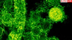 Viral Infection: देश में वायरल इंफेक्शन बढ़ा तो डॉक्टरों ने किया अलर्ट, डरा देगी ICMR  की रिपोर्ट