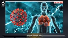 AI ਨੇ TB ਰੋਕਣ ਦਾ ਨਵਾਂ ਤਰੀਕਾ ਲੱਭਿਆ! ਘਟਣਗੇ ਮੌਤ ਦੇ ਅੰਕੜੇ? ਜਾਣੋ ਇਹ ਵੱਡਾ ਬਦਲਾਅ!