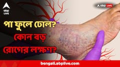 পা ফুলছে রোজ? ভারী পায়ের পাতা? তিনটি বড় অঙ্গ ক্ষতিগ্রস্ত হওয়ার ইঙ্গিত, কোন ডাক্তারকে দেখাবেন?