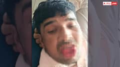 धोखेबाज प्रेमी से बदला लेने के लिए प्रेमिका का खौफनाक कदम, KISS करते समय काट डाली जीभ