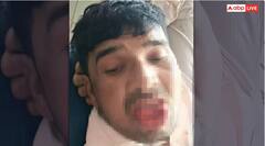 ਧੋਖੇਬਾਜ਼ ਪ੍ਰੇਮੀ ਤੋਂ ਬਦਲਾ ਲੈਣ ਲਈ ਸਹੇਲੀ ਨੇ ਚੁੱਕਿਆ ਖ਼ੌਫਨਾਕ ਕਦਮ ! kiss ਕਰਨ ਵੇਲੇ ਵੱਢ ਦਿੱਤੀ ਉਸ ਦੀ ਜੀਭ, ਹਸਪਤਾਲ ਭਰਤੀ