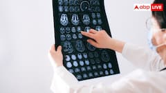 जल्दी दिमागी कमजोरी से बचना है? अपनाएं ब्रेन को फिट रखने वाले 5 जरूरी नियम