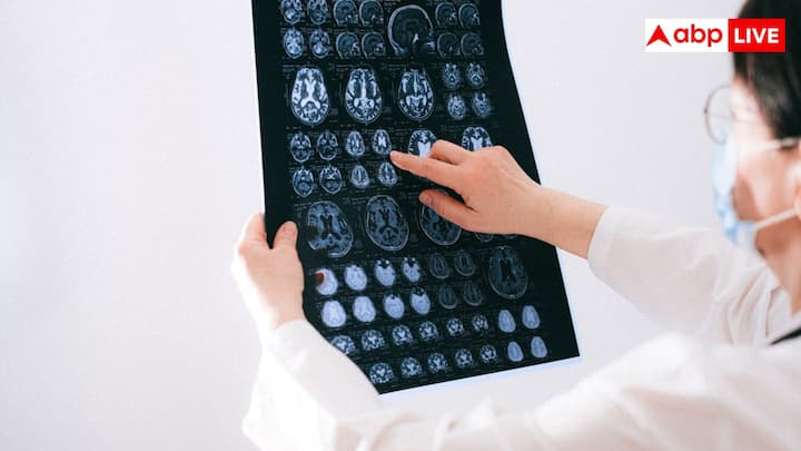 एक्सपर्ट्स के अनुसार दिमाग को फिट रखने के लिए सबसे पहले डिसिप्लिन स्लीप रूटीन जरूरी है. रोजाना 6 से 8 घंटे की नींद लेने के साथ-साथ एक समान सोने और जागने का समय बनाए रखना बहुत जरूरी है.