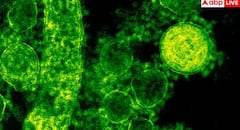 Viral Infection: દેશમાં વાયરલ ઇન્ફ્રેક્શન વધતા ડોક્ટરોએ કર્યા એલર્ટ, ડરાવી રહ્યો છે ICMRનો રિપોર્ટ