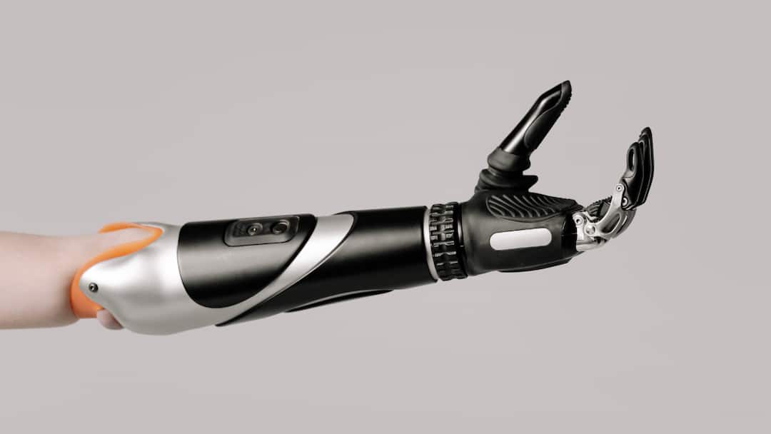 How Advanced Prosthetics Are Changing Lives In India? Know Here