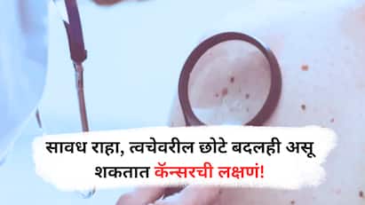 skin cancer symptoms : त्वचेचा कर्करोग सूर्याच्या अतिनील किरणांमुळे जास्त होतो, त्याची लक्षणे लवकर ओळखणे आणि सनस्क्रीनसह योग्य संरक्षण करणे हा धोका कमी करण्याचा सर्वोत्तम मार्ग आहे.
