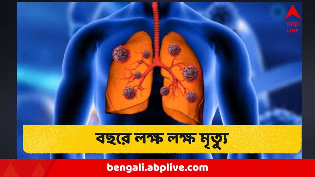 Health News : ঠিক এই কারণে ভারতে প্রতি বছর লক্ষ লক্ষ মৃত্যু! শীতেই বাড়াবাড়ি সবথেকে বেশি Lung crisis In India COPD surged to no. 2 killer in 30 years Health News : ঠিক এই কারণে ভারতে প্রতি বছর লক্ষ লক্ষ মৃত্যু! শীতেই বাড়াবাড়ি সবথেকে বেশি