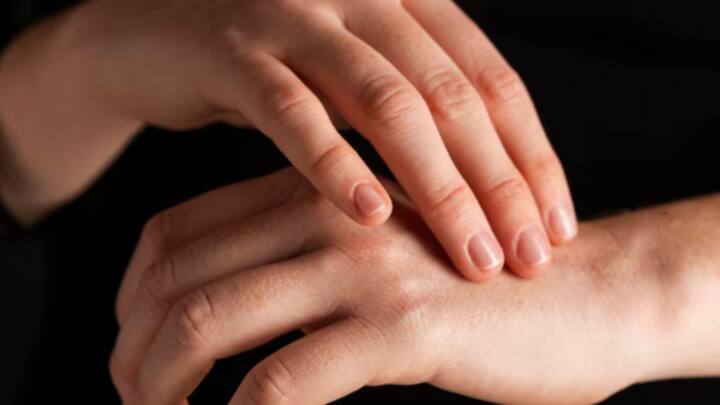 শীতকাল মানে শুধু ঠোঁট বা পা ফাটা নয়। এই সময় হাতও একেবারে খসখসে হয়ে যায়, ফাটতেও শুরু করে। বাইরে হাত বের করতেও কুণ্ঠা বোধ করি আমরা।