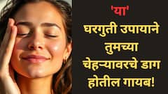 Skincare Tips:चेहऱ्यावरचे सगळे डाग होतील गायब! जाणून घ्या हे घरगुती उपाय...
