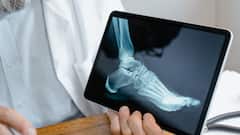 When To See An Orthopaedic Specialist: Early Warning Signs You Shouldn’t Ignore