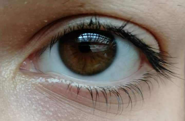 অ্যালার্জিক কনজাংটিভাইটিস আরেকটি কারণ। ধুলো, ময়লা, পরাগ, পোষা প্রাণীর লোম বা মেকআপ পণ্যের কারণে এই অ্যালার্জি হয়। এতে চোখ জল আসা, চুলকানি এবং লাল হওয়ার মতো লক্ষণ দেখা যায়।