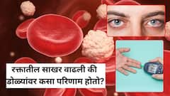 रक्तातील साखर वाढली की डोळ्यांवर कसा परिणाम होतो? डॉक्टरांनी सांगितले गंभीर परिणाम