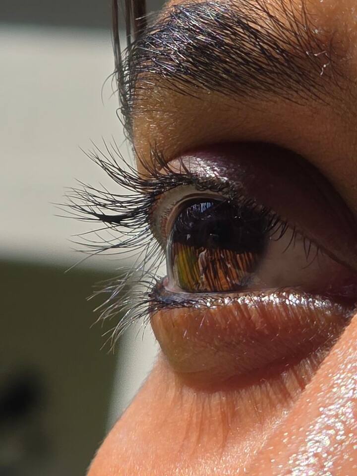 অ্যালার্জি এড়াতে ধুলো ধোঁয়া এবং জোরে হাওয়া থেকে চোখের সুরক্ষা করুন।