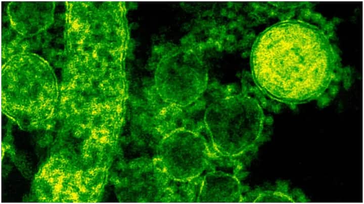 ICMR Warning on Viral Infections : దేశంలో వైరల్ ఇన్ఫెక్షన్లు పెరుగుతున్నాయి. వాతావరణం మారడంతో కేసులు పెరుగుతున్నాయి. నివారణ చర్యలు, వైద్యుల సలహాలు తెలుసుకోండి.