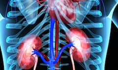 Kidney Failure: ਕਿਡਨੀ ਲਈ ਵੱਡਾ ਖਤਰਾ ਇਹ 3 ਚੀਜ਼ਾਂ, ਜਾਣੋ ਕਿਵੇਂ ਮੌਤ ਨੂੰ ਦਿੰਦੇ ਬੁਲਾਵਾ; ਇੰਝ ਫੇਲ੍ਹ ਹੁੰਦੀ Kidney...