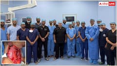 सफदरजंग अस्पताल ने रचा इतिहास, पहली बार 11 साल के बच्चे का सफल किडनी ट्रांसप्लांट