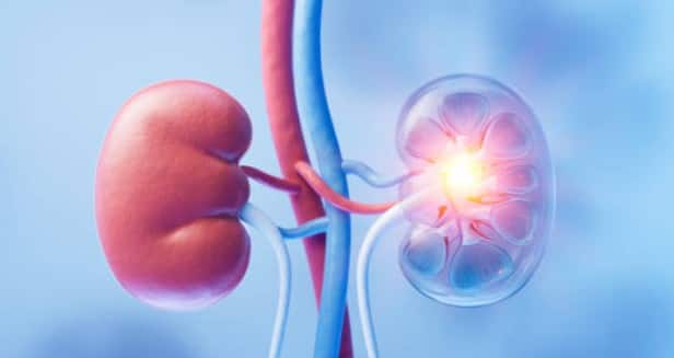 ਬਹੁਤ ਜ਼ਿਆਦਾ ਚਰਬੀ ਵਾਲਾ ਭੋਜਨ ਖਾਣਾ: ਲੋਕ ਅਕਸਰ ਸਰਦੀਆਂ ਦੌਰਾਨ ਜ਼ਿਆਦਾ ਖਾਂਦੇ ਹਨ, ਜੋ ਉਨ੍ਹਾਂ ਦੇ ਸਰੀਰ ਅਤੇ ਗੁਰਦਿਆਂ ਦੋਵਾਂ ਲਈ ਚੰਗਾ ਨਹੀਂ ਹੁੰਦਾ। ਆਪਣੇ ਗੁਰਦਿਆਂ ਨੂੰ ਸਿਹਤਮੰਦ ਰੱਖਣ ਲਈ, ਤੁਹਾਨੂੰ ਹਰ ਰੋਜ਼ ਇੱਕ ਸਿਹਤਮੰਦ ਅਤੇ ਸੰਤੁਲਿਤ ਖੁਰਾਕ ਖਾਣੀ ਚਾਹੀਦੀ ਹੈ। ਚਰਬੀ, ਤੇਲ, ਖੰਡ ਅਤੇ ਕਾਰਬੋਹਾਈਡਰੇਟ ਵਾਲੇ ਭੋਜਨਾਂ ਤੋਂ ਪਰਹੇਜ਼ ਕਰੋ। ਗੁਰਦੇ ਦੀ ਪੱਥਰੀ ਤੋਂ ਬਚਣ ਦੇ ਤਰੀਕੇ: ਤੁਸੀਂ ਸ਼ਾਇਦ ਸੁਣਿਆ ਹੋਵੇਗਾ ਕਿ ਰੋਕਥਾਮ ਇਲਾਜ ਨਾਲੋਂ ਬਿਹਤਰ ਹੈ। ਗੁਰਦੇ ਦੀ ਪੱਥਰੀ ਦੇ ਜੋਖਮ ਨੂੰ ਘਟਾਉਣ ਲਈ ਇੱਥੇ ਕੁਝ ਸੁਝਾਅ ਹਨ। 1. ਸਰਦੀਆਂ ਹੋਣ ਜਾਂ ਗਰਮੀਆਂ, ਡੀਹਾਈਡਰੇਸ਼ਨ ਤੋਂ ਬਚੋ। ਦਿਨ ਭਰ ਬਹੁਤ ਸਾਰਾ ਪਾਣੀ ਪੀਣ ਨਾਲ ਪਿਸ਼ਾਬ ਪਤਲਾ ਹੋ ਜਾਂਦਾ ਹੈ ਅਤੇ ਪੱਥਰੀ ਬਣਨ ਦਾ ਜੋਖਮ ਘੱਟ ਜਾਂਦਾ ਹੈ। ਇਸ ਲਈ, ਰੋਜ਼ਾਨਾ ਘੱਟੋ-ਘੱਟ 2-3 ਲੀਟਰ ਪਾਣੀ ਪੀਣ ਦਾ ਟੀਚਾ ਰੱਖੋ।