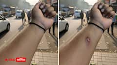 રજા લેવા માટે ગજબનો જુગાડ! સાજા હાથ પર AI થી બનાવ્યો લોહીવાળો ઘા, HR પણ થાપ ખાઈ ગયા