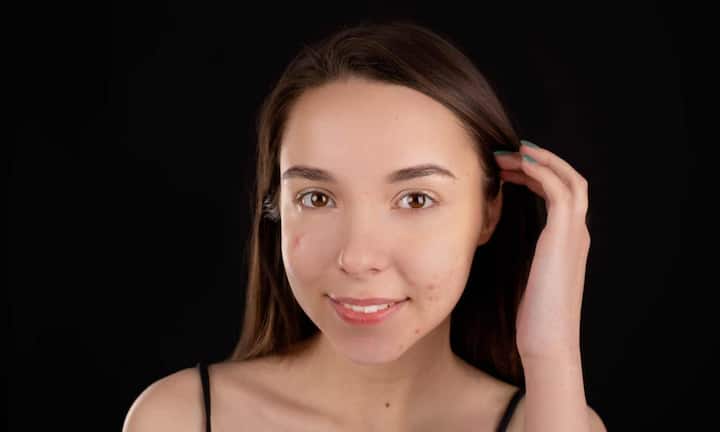 अगर बिना दाने या रेशे के लगातार खुजली हो रही है तो यह भी लिवर से जुड़ी परेशानी का संकेत हो सकता है. इसके अलावा स्किन का रंग असामान्य रूप से बदलना आसानी से चोट लग जाना या स्किन का गहरा या फीका पड़ना भी लिवर की बीमारी से जुड़ा माना जाता है. यह बदलाव धीरे-धीरे नजर आते हैं और कई बार महीनों तक चलते रहते हैं.