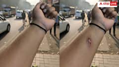 'गजब टोपीबाज अदमी है' एआई से बनाई चोट वाली तस्वीर और एचआर से ले ली छुट्टी- यूजर्स बोले, भेड़िये वाली कहानी भूल गए?