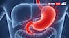 From Heartburn To Hazard: When Indigestion Becomes A Serious Health Warning