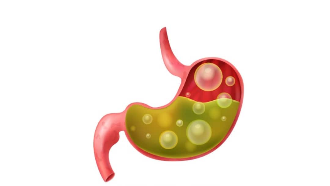 Indigestion Warning Signs : అజీర్ణ ప్రమాద హెచ్చరికలు.. గుండె నొప్పి నుంచి క్యాన్సర్ వరకు, నిపుణుల సలహాలివే Indigestion Could Be Bigger Problem Know the Risks Warning Signs You Shouldnt Ignore Indigestion Warning Signs : అజీర్ణ ప్రమాద హెచ్చరికలు.. గుండె నొప్పి నుంచి క్యాన్సర్ వరకు, నిపుణుల సలహాలివే