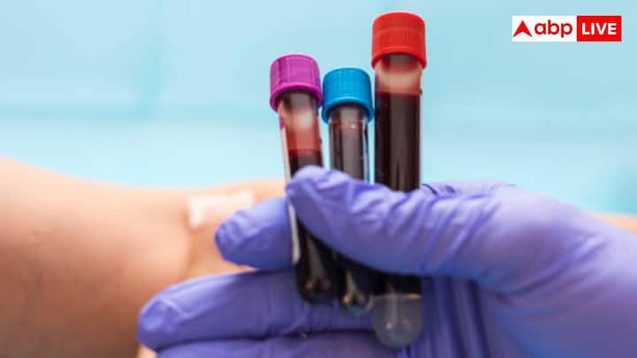 अगर किसी भी व्यक्ति को ऐसा खून चढ़ा दिया जाए जिसमें ऐसे एंटीजन हो जिन्हें उसका शरीर पहचानता नहीं है तो इम्यून सिस्टम उस पर हमला कर देता है. यही वजह है कि सुरक्षित ब्लड ट्रांसफ्यूजन के लिए ABO सिस्टम जरूरी है.