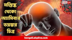 ১ বছরে চতুর্গুণ বেড়েছে কেরলে মস্তিষ্ক-খেকো অ্যামিবার সংক্রমণ! সংসদের আলোচনায় আতঙ্কের চিত্র