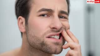 Gum Swelling Treatment: मसूड़ों से आ रहा है खून या मुंह से बदबू? घर पर बनाएं ये देसी टूथपेस्ट